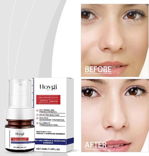 Vitamin C + Walnut Extract, cream texture is moisturizing without being greasy. Suitable for those with sensitive skin prone to oiliness. After application, dullness and dark spots fade, leaving a radiant complexion and a smooth makeup application. Order today and you'll receive 2 bottles. The press-down bottle is not wasted. It gently brightens without causing irritation. This batch of stockpiling will fully boost your brightening confidence.