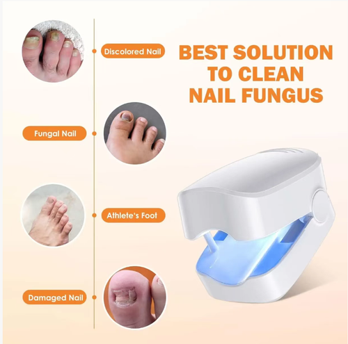 Order today and you will receive 2 ultraviolet onychomycosis fungal lamp mini phototherapy devices. They can penetrate deep into the nail plate. It has a 7-minute intelligent timer that automatically turns off without any operation. It is small in size and easy to carry. It is painless and non-irritating. You can easily inhibit fungi at home without the need for medication assistance. It can help you solve the problem of onychomycosis and restore healthy and lustrous nails.