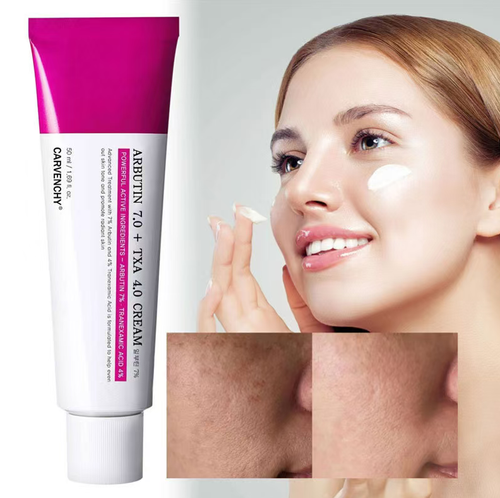 Acne scars are bothering you? This bearberry extract cream can fade scars and acne simultaneously. It has a water-based gel texture that is transparent and non-greasy, providing both hydration and oil control. It can also fade sunspots and acne marks. Order today and get 5 bottles. Each bottle is priced at the price of a cup of milk tea. It can be used for post-sun emergency treatment and daily maintenance.