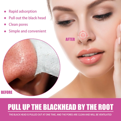 If you place an order today, we will send you a total of 8 bottles (4 bottles of nose strips + 4 bottles of toner) along with an additional 120 pieces of blackhead paper, the aloe vera blackhead removal set. It is a natural formula that gently softens and absorbs, removing blackhead oil within 10 minutes. It's easy to clean at home, leaving pores clean and not red, suitable even for sensitive skin!