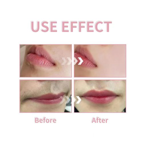 Order today and you will receive 3 boxes of the gentle, painless and quick hair removal spray. This spray has a mild formula and is suitable for skin use, without causing irritation. When used in combination with eyebrow scissors, it can precisely remove excess hair, providing a smooth base for makeup and making the makeup more flawless. It is an excellent helper for daily facial care and makeup base.