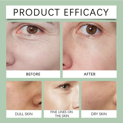 Order today and you will receive 2 bottles of the doctor-recommended collagen filling anti-wrinkle slimming firming and shaping cream. This firming anti-wrinkle facial cream: After use, your skin will feel firm, wrinkles will disappear, and your tired face will regain its radiance. The large-capacity bottle is sturdy and durable, and one bottle is sufficient to meet the needs of anti-aging, moisturizing and brightening the skin.