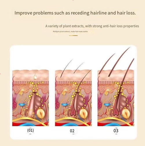 Order today and you will receive 2 bottles of White Hack Anti-Hair Loss Shampoo. It contains wolfberry + herbal extracts. After each use, it strengthens the hair roots, reduces hair loss and promotes thick hair growth. The foam is thick and can remove grease. Oily hair becomes soft and fluffy. After washing, the hair is moisturized and not frizzy. It is suitable for sensitive scalps and can be used without revealing the scalp when wearing a bun hairstyle.