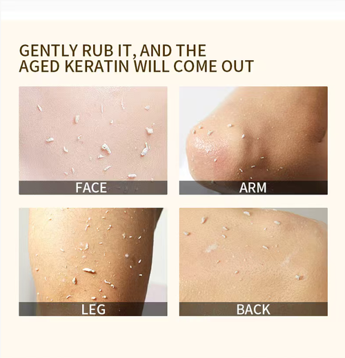 Order today and you will receive 5 bottles of Orange Enzyme Exfoliating and Blackhead Removing Deep Cleansing Gel. It contains gentle enzymes that can break down dead skin cells. It can be used on facial skin and effectively unclogs pores, lightens pigmentation, and nourishes the skin. After use, the skin will feel soft and not tight, and it will naturally have a lustrous appearance even without makeup.