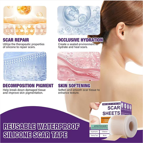 Order today and you will receive 3 packs of soothing skin scar silicone patches. These patches feature a three-layer design that can lock in moisture and provide a moisturizing effect. They can gently reduce both new and old scars, relieve itching and excessive growth symptoms. The patches can be washed and reused, are waterproof and unnoticeable. They are suitable for various types of scars, such as cesarean scar and post-operative scar conditions. It is a practical choice for skin repair.