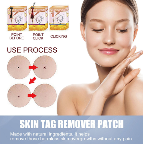 Verruca Removal Patches for Genital Warts and Other Verrucous Lesions. The patches contain vitamin E + tea tree oil. Once applied, they become invisible. Within 7-14 days, the skin tags will naturally fall off. It is non-invasive, painless and does not damage the skin.144 patches in a large package. Place an order today and you will receive 2 boxes upon delivery. It is sufficient for home use. There will be no scars after application. The skin will be smooth and comfortable!