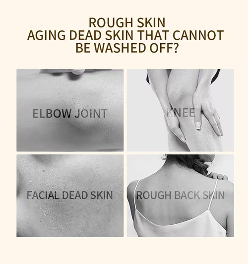 Order today and you will receive 5 bottles of Orange Enzyme Exfoliating and Blackhead Removing Deep Cleansing Gel. It contains gentle enzymes that can break down dead skin cells. It can be used on facial skin and effectively unclogs pores, lightens pigmentation, and nourishes the skin. After use, the skin will feel soft and not tight, and it will naturally have a lustrous appearance even without makeup.