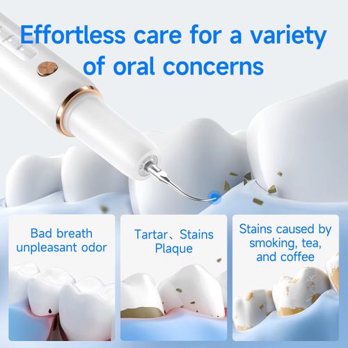 A 3 million times per minute ultrasonic toothbrushing device enables you to thoroughly clean your teeth at home. It intelligently senses pressure to protect the gums and uses purple light and an antibacterial cover to lock in bacteria. With 5 different brush heads targeting hard-to-reach areas, it can clean away plaque in just 2 minutes. It freshens your breath and gives you more confidence when smiling with teeth exposed!