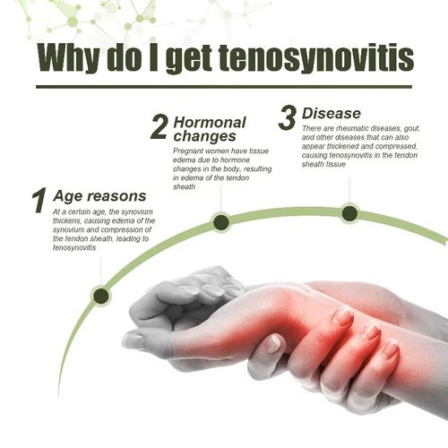 If you place an order today, you will receive 3 bottles of tendon gel spray. It contains herbal ingredients that are gentle on the skin and easy to carry. It is suitable for people with tendon discomfort and can help maintain wrist health and restore hand flexibility. It is the savior for those seeking to restore hand mobility.