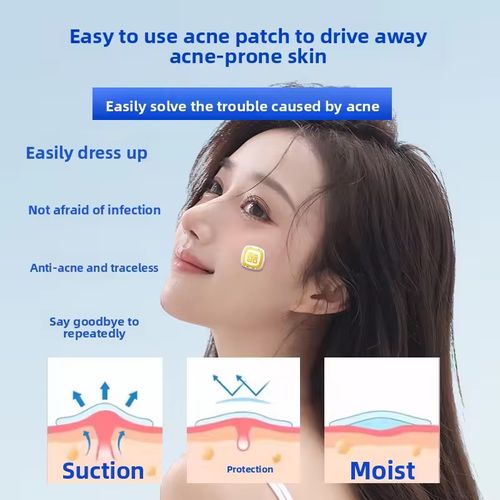 MXYE Advanced Meow Xiao Yi Electronic Acne Patch with Precision Microchip Technology, 460nm Blue Light for Propionibacterium Acnes Elimination & 630nm Red Light for Anti-Inflammatory Repair, Infused with Salicylic Acid, Centella Asiatica & Calendula, Hydrocolloid Waterproof Isolation Acne Treatment Patch for Cystic Acne, Pimples, and Acne-Prone Skin, Strong Deep Penetration, No Acne Marks, Safe for Wound Healing