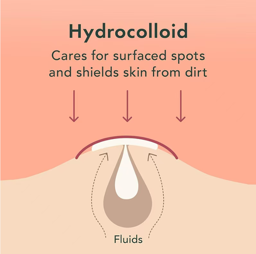 Powerful acne-removing patches. If you place an order today, you will receive a total of two boxes of products, with 96 patches each! This hydrogel technology can absorb acne secretions, isolate contaminants, create a transparent matte effect, and will not clog cosmetics. It is suitable for sensitive skin. Red and swollen acne, whitehead acne - one patch will work! Quickly eliminate acne and restore your smooth and beautiful skin condition.