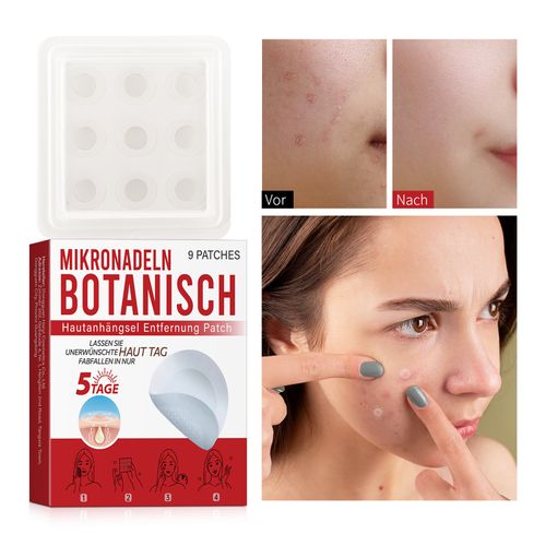 Skin tag removal patch. I placed an order today and received 2 boxes, a total of 162 patches. I have enough to thoroughly remove skin tags on my neck, armpits, and around my eyes. The plant micro-needles gently penetrate, making the skin tags dry and fall off within 5-7 days. The invisible thin patches are not noticeable. Sensitive skin can use it without red marks. You can easily achieve skin purification at home and feel more confident with a bare face!