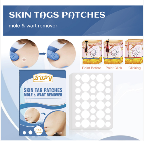 Verruca Removal Patches for Genital Warts and Other Verrucous Lesions. The patches contain vitamin E + tea tree oil. Once applied, they become invisible. Within 7-14 days, the skin tags will naturally fall off. It is non-invasive, painless and does not damage the skin.144 patches in a large package. Place an order today and you will receive 2 boxes upon delivery. It is sufficient for home use. There will be no scars after application. The skin will be smooth and comfortable!