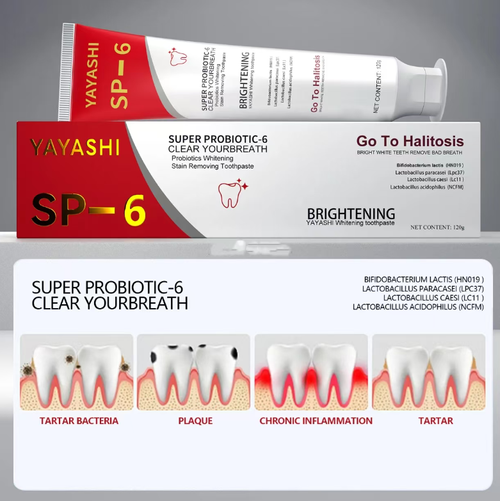 SP6 Probiotic Oral Bacteria Eliminator Toothpaste is specially designed to eliminate bad breath bacteria. It can also remove cigarette stains and brighten yellow teeth. It contains soothing ingredients to suit sensitive teeth. After brushing, it provides long-lasting freshness. It is a must-have for smokers and tea coffee lovers. One tube lasts for 2 months. Order today and get 10 tubes, which is enough to stock up for nearly two years!