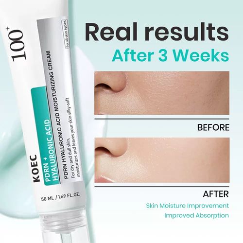KOEC 100 PDRN Compound High-Purity Hyaluronic Acid Moisturizing Facial Cream: A specialized formula for repairing dry and dull skin, deeply penetrating to hydrate. It forms a long-lasting water-lock barrier, and after 3 weeks, you'll notice a more refined skin texture and enhanced absorption. The dropper design ensures hygiene and convenience. This silky, smooth, moisturizing and luxurious cream is suitable for both day and night use.
