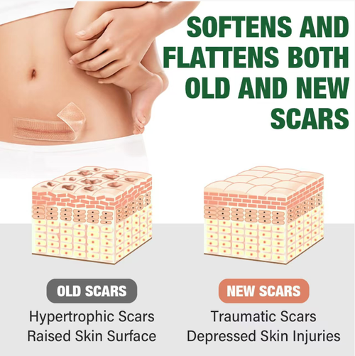 Order today and you will receive 3 packs of soothing skin scar silicone patches. These patches feature a three-layer design that can lock in moisture and provide a moisturizing effect. They can gently reduce both new and old scars, relieve itching and excessive growth symptoms. The patches can be washed and reused, are waterproof and unnoticeable. They are suitable for various types of scars, such as cesarean scar and post-operative scar conditions. It is a practical choice for skin repair.