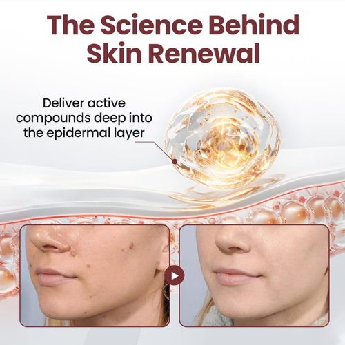 Whitening and Rejuvenating Dual-Function Skin Renewal Cream. Order today and take home 4 bottles! Eliminate dull and old skin cells, activate skin regeneration, and within 28 days, rough skin becomes smooth and yellowish discoloration fades by half a circle. After use, the skin feels smooth and soft like polished, giving a naturally luminous appearance when bare-faced. Apply at home to achieve a smooth-skin texture with exfoliation.