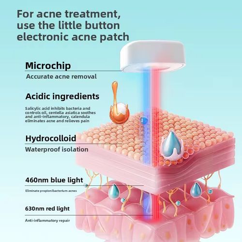 MXYE Advanced Meow Xiao Yi Electronic Acne Patch with Precision Microchip Technology, 460nm Blue Light for Propionibacterium Acnes Elimination & 630nm Red Light for Anti-Inflammatory Repair, Infused with Salicylic Acid, Centella Asiatica & Calendula, Hydrocolloid Waterproof Isolation Acne Treatment Patch for Cystic Acne, Pimples, and Acne-Prone Skin, Strong Deep Penetration, No Acne Marks, Safe for Wound Healing