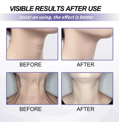 Order today and you'll receive 5 bottles of the neck firming and moisturizing cream. It can be used for two months and you'll notice significant results. It contains 4% Guabasu butter, which is moisturizing yet non-greasy. Apply for 2 minutes every day, and you'll see smoother neck lines and a more defined contour. You'll achieve a delicate neck like a swan's, and feel more confident when wearing low-neck clothes!