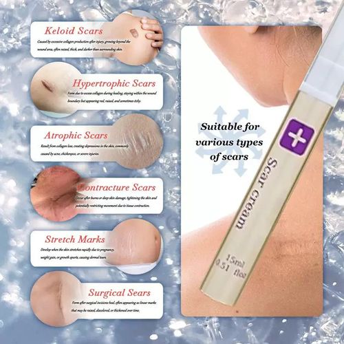 Scar Care Gel, one tube covers 20cm of scar, 3-pack (order today and get 3 boxes, which can cover 60cm). It can repair 60cm of soft hypertrophic scars, light acne marks  surgical scars, and reduce pregnancy lines. The transparent gel is not sticky and can be used for sensitive skin  post-operative skin. Apply it daily, and the scar will gradually become flat, soft and clean. There is no need to cover the exposed skin. Easily regain confidence.