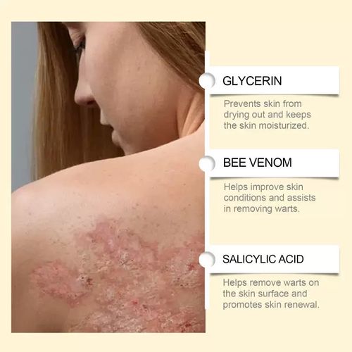 Today, we are releasing 3 bottles of Bee Venom Care Cream. Each tube can relieve dryness, redness and roughness! Bee venom glycerin comfrey extract, it repairs and locks in moisture, softens the skin, and is absorbed instantly with a butter-like texture. Within 15 minutes, the stinging sensation subsides, redness and blood vessels fade, and pores become smaller. Old fans praise it as No recurrence of dryness and itching, and the joints are smooth and slippery!