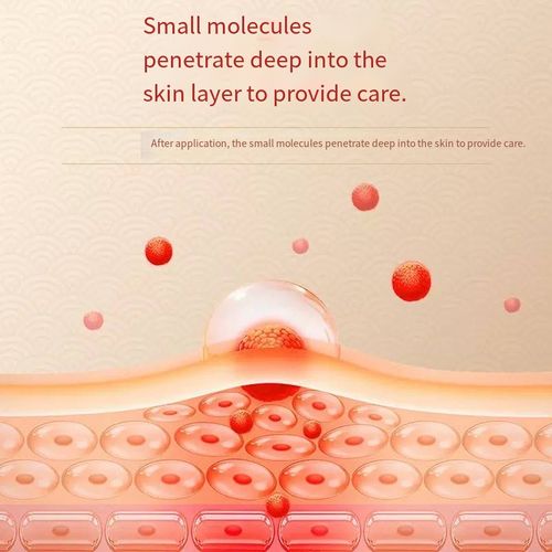 Don't suffer from shoulder and waist pain in silence! The Shoulder and Waist Bone-Relieving Liquid can help. Order today and you'll get 5 bottles. Herbal formula + small molecule penetration. It absorbs instantly when applied. Warm and soothing, it relieves stiffness and pain. Liquid and portable, apply it wherever your shoulder, waist or knees are uncomfortable. Suitable for the whole family for 6 months. Regular application can relieve pain and resist cold and dampness.