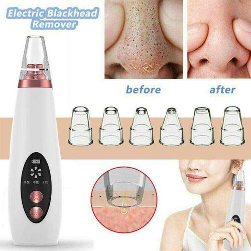 Heads Rechargeable Facial Skin Care Tool Blackhead Vacuum Acne Cleaner Pore Remover Blackhaed Remover Vacuum