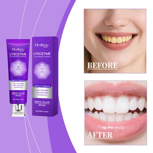 ORALHOE Purple Toothpaste – Deep Cleansing, Oral Hygiene Care, Daily Teeth & Mouth Cleaner