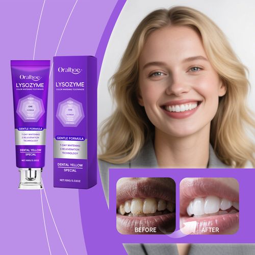 ORALHOE Purple Toothpaste – Deep Cleansing, Oral Hygiene Care, Daily Teeth & Mouth Cleaner