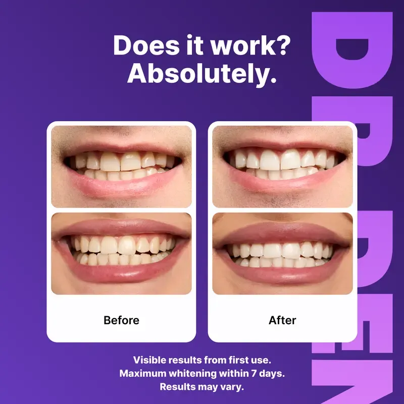 DRDENT Purple Teeth Whitening Strips  21 Whitening Sessions - Safe for Enamel - Non Sensitive Teeth Whitening - Peroxide-Free