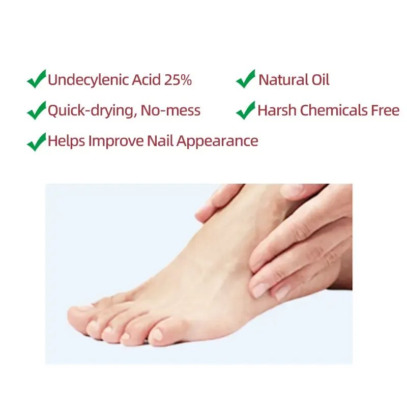 Strength Nail Renewal Pen - Restores Clarity for Discolored, Thick & Damaged Nails - Easy Brush Applicator