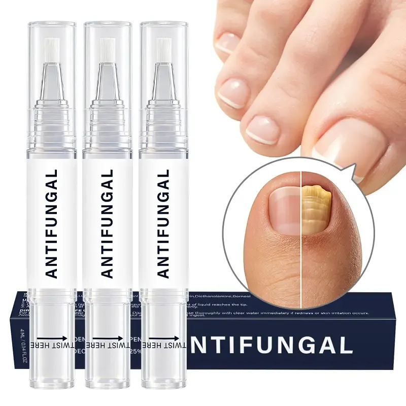 Strength Nail Renewal Pen - Restores Clarity for Discolored, Thick & Damaged Nails - Easy Brush Applicator