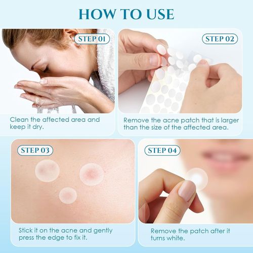 Invisible Acne Patch | Wear It Like It's Not There, Invisible from Social Distance