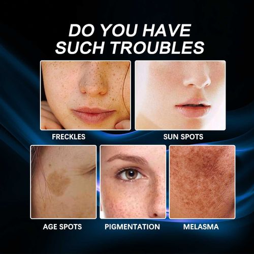 Dark Spot & Brightening Serum  | Evens Skin Tone for a Radiant Glow