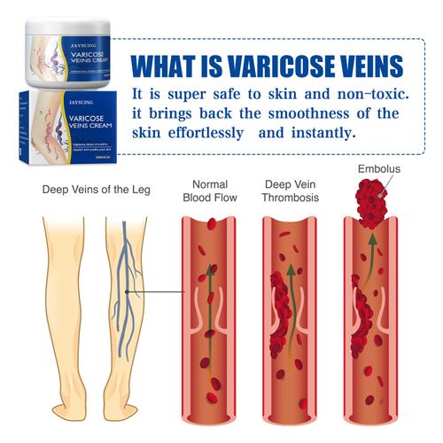 Leg Revitalizing Cream | Cooling Gel for Tired, Heavy Legs & Circulation Support | with Horse Chestnut & Menthol