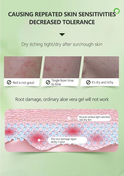 Aloe Vera Gel | After-Sun Repair, One Bottle Does It All