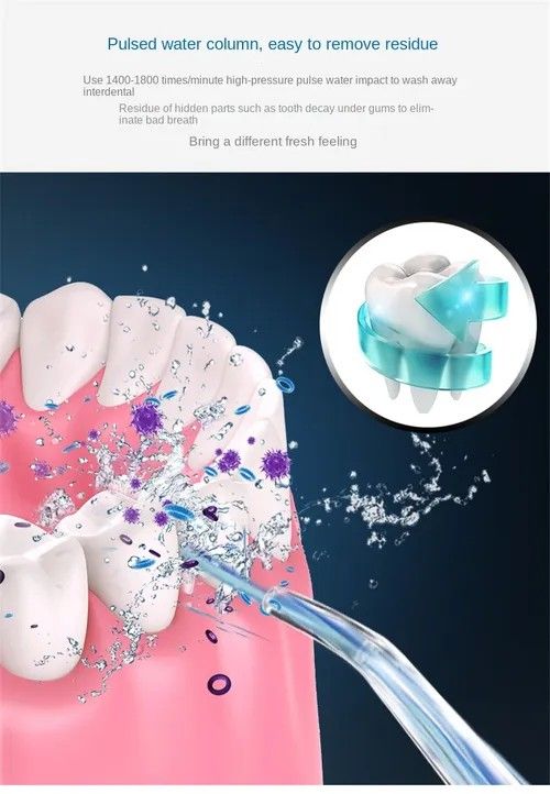 Smart Electric Water Flosser | Deep Clean Between Teeth, Protect Gum Health