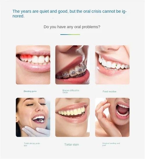 Smart Electric Water Flosser | Deep Clean Between Teeth, Protect Gum Health