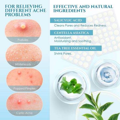 Invisible Acne Patch | Wear It Like It's Not There, Invisible from Social Distance