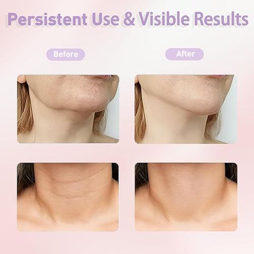 Massajador para pescoço e rosto