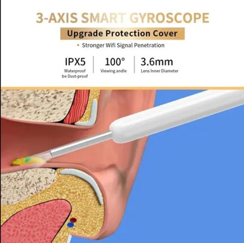 1080P Ear Wax Removal Camera + 8-piece tool set