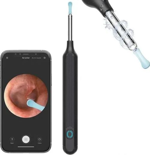 1080P Ear Wax Removal Camera + 8-piece tool set