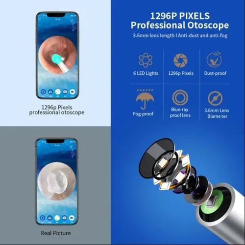 1080P Ear Wax Removal Camera + 8-piece tool set