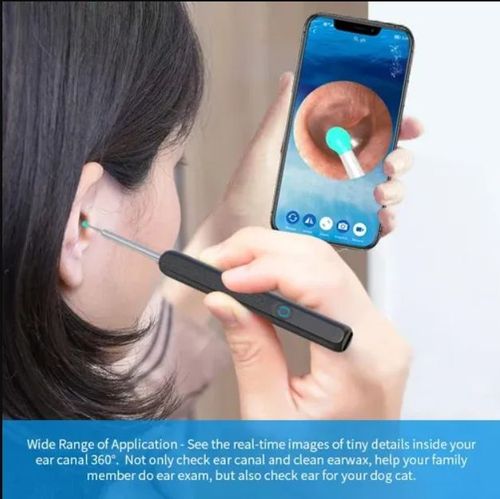 1080P Ear Wax Removal Camera + 8-piece tool set
