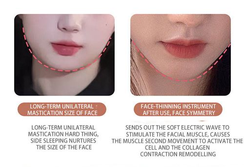 Handheld V-shaped double chin remover, skin tightening and lifting treatment device, 3D roller massage beauty device with USB cable.
