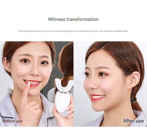Hands-free brushing is now here! Brush in 10 seconds with 0 hassle. Fully automatic adult U-shaped electric toothbrush ultrasonic teeth whitening device whitening water-imitation silicone braces mouth whitening device