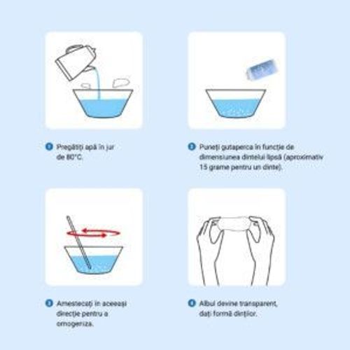 INSTASMILE – quick smile restoration for broken, missing or spaced teeth