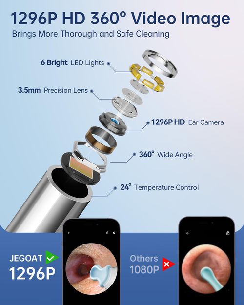 🔥HOT SALE🔥 COD！Visual Ear Scoop, Wireless WiFi Endoscope, High-Definition Ear Cleaning