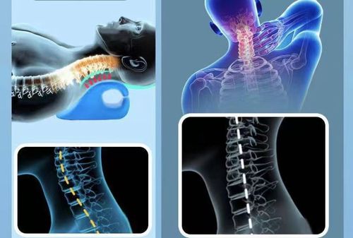 Hot selling c-shaped massage pillow massage cervical pillow spine correction cervical pillow acupressure traction pillow cervical massager c-shaped pillow