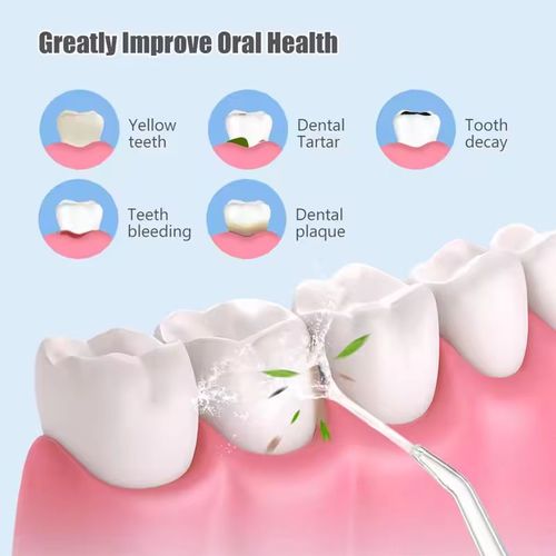 Teeth Cleaner